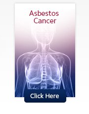 Asbestos Cancer